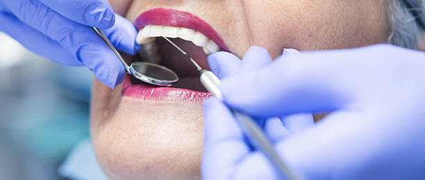 Best Teeth Whitening  in Fairmount, CO